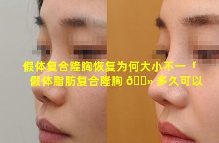 假体复合隆胸恢复为何大小不一「假体脂肪复合隆胸 🌻 多久可以侧卧睡觉」